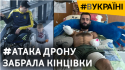 Історії важких поранень у запеклих боях: військові показують наслідки і відновлення | #ВУКРАЇНІ Історії важких поранень у запеклих боях: військові показують наслідки і відновлення | #ВУКРАЇНІ