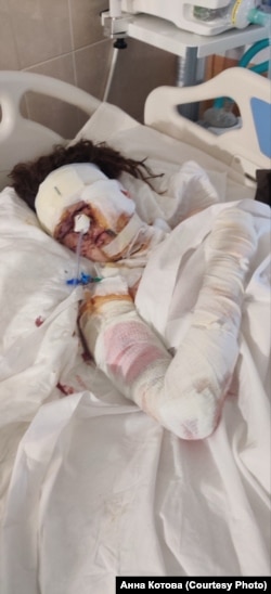 Анна Котова в лікарні після ракетного удару по Дніпру 14 січня 2023 року