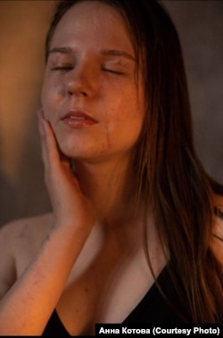 Анна Котова бере участь у проєкті з відновлення зовнішності після ракетного удару