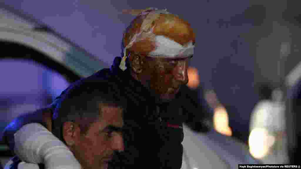 Мужчине, пострадавшему в результате взрыва на топливном складе недалеко от Степанакерта в Нагорном Карабахе, помогают выйти из машины скорой помощи. Его привезли в ожоговый центр в Ереване. Омбудсмен сепаратистского региона Гегам Степанян сообщил Армянской редакции Азаттыка, что в результате взрыва, по подтверждённым данным, погибли 68 человек. Взрыв произошёл, когда машины с людьми, направляющимися в Армению, выстроились в очередь за бензином