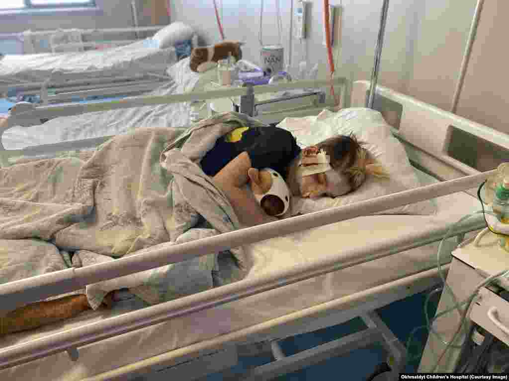 Володі було 13 років, коли 26 лютого 2022 року він потрапив до лікарні «Охматдит». Його сім'я намагалася виїхати з Києва, та натрапила на російських солдатів. Батько та шестирічний брат Володі загинули під час обстрілу. Сам хлопчик отримав поранення в обличчя та спину, але залишився живим завдяки допомозі лікарів