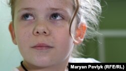 Ці цяточки на обличчі залишились після поранення