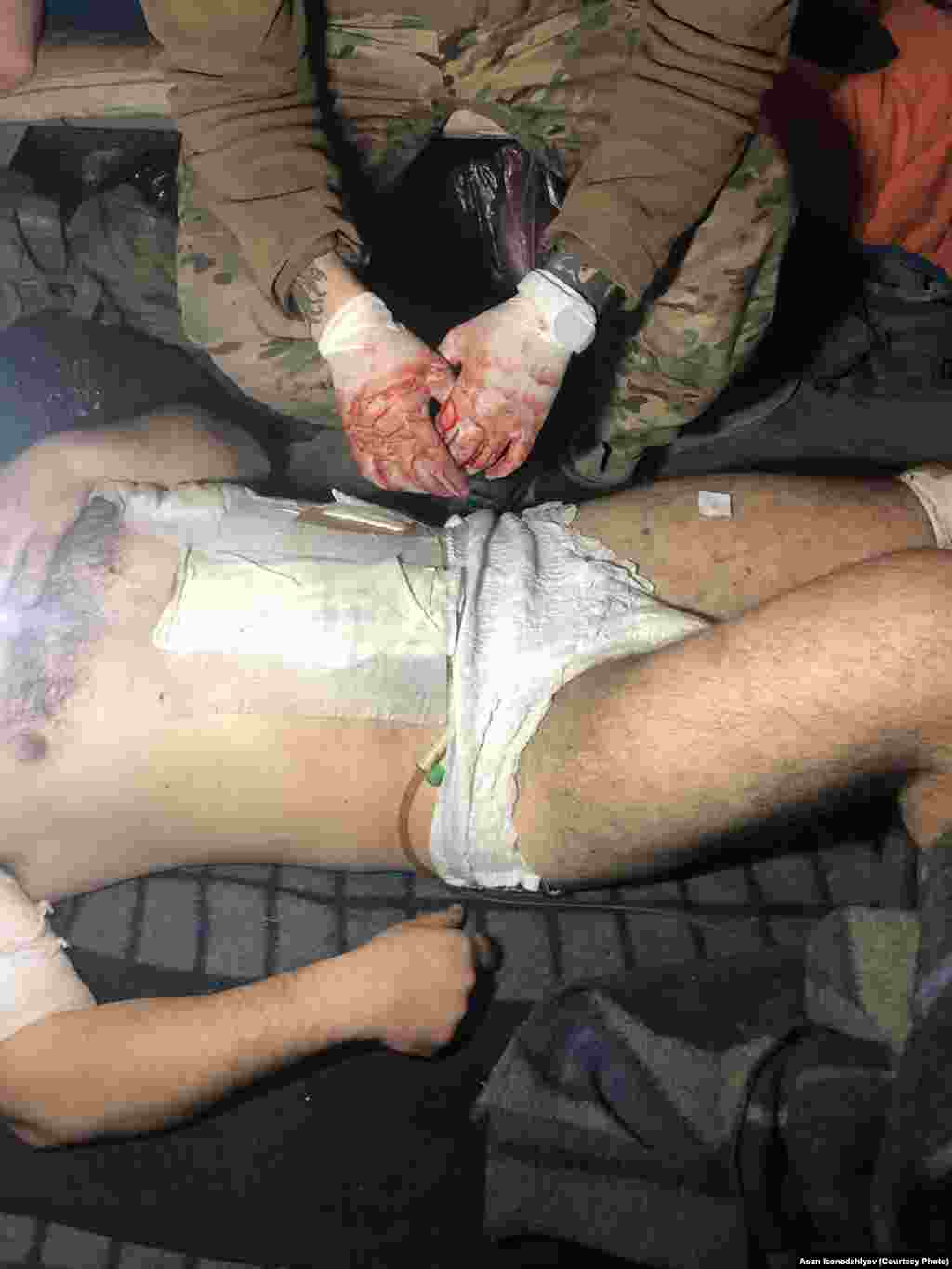 Цей військовий помер на території «Азовсталі». Він отримав тяжкі поранення, потрапивши під вогонь армії РФ. Попри всі зусилля медиків, його не вдалося врятувати. За словами Асана, військові помирали, зокрема й через те, що бракувало медикаментів та антисептиків