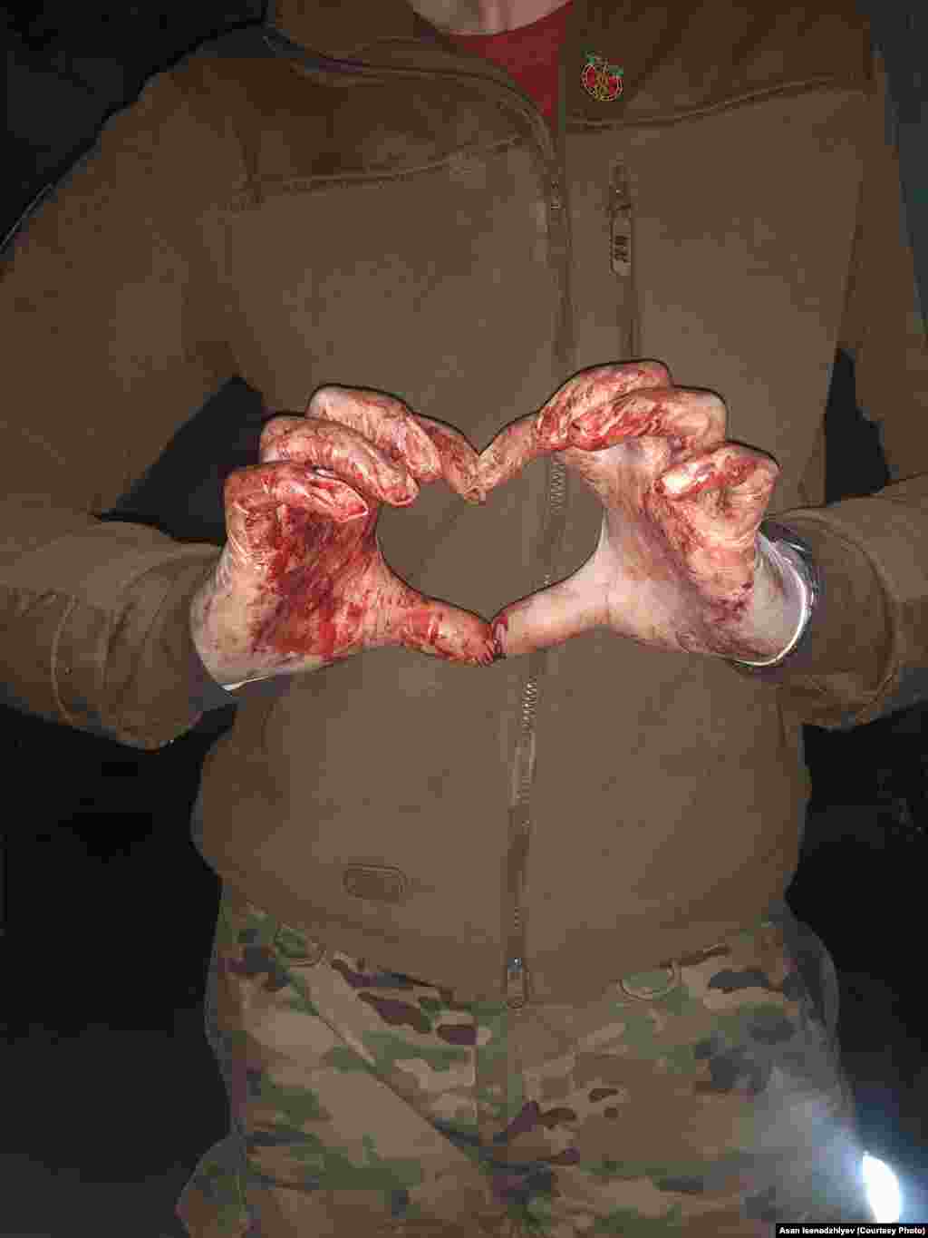 На цій світлині – руки медика Асана Ісенаджиєва у крові на «Азовсталі». Опублікувавши її в інстаграмі, Асан написав: «Передайте моїй мамі слова – я побачив стільки болю, але не зламаюся ніколи». Витримавши 83 дні оборони та 227 днів полону, Асан завершив військову службу. Зараз він проводить курси з надання домедичної допомоги 