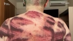 Нападение на Елену Милашину и Александра Немова Нападение на Елену Милашину и Александра Немова