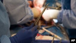 Operacija transplantacije organa (ilustrativna fotografija)