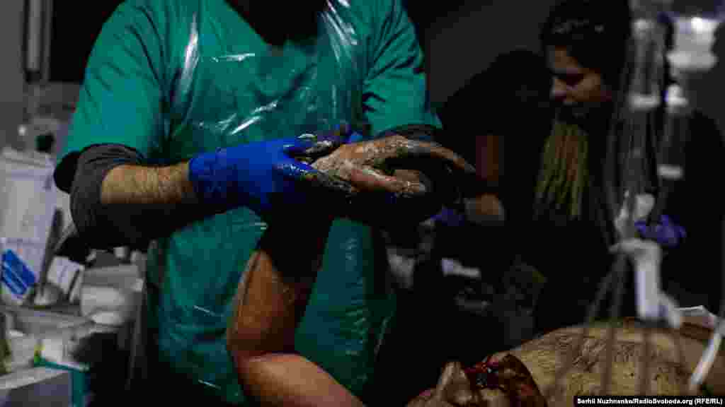 Бійці часто потрапляють до медиків, укриті товстим шаром бруду. Війна – це бруд і кров.   Тож, у процесі надання медичної допомоги, лікарі ще й змивають із поранених грязюку та бруд боїв.