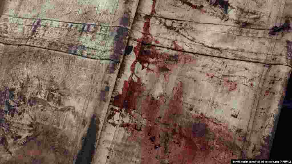 …і запечена кров на них