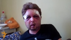 Политолог движения Femen утверждает, что его избили спецслужбы Политолог движения Femen утверждает, что его избили спецслужбы