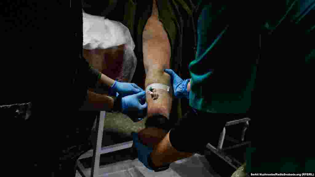 Пораненому вставляють в руку катетер, як кажуть медики: «поставити вену». Це допомагає вести в організм людини необхідні медпрепарати, що полегшать біль та стабілізують стан пацієнта.