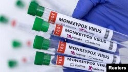 На Північну та Південну Америку припадає більше половини підтверджених випадків у світі, а в деяких країнах все ще спостерігається зростання кількості хворих