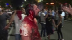 Нічні сутички із поліцією у Грузії: сльозогінний газ, травматична зброя та водомети – відео Нічні сутички із поліцією у Грузії: сльозогінний газ, травматична зброя та водомети – відео