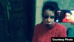 Тетяна Чорновол, побита невідомими, 25 грудня 2013 року