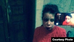 Тетяна Чорновол, громадська активістка, побита невідомими (фото з соціальних мереж)