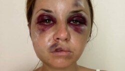 Анастасія Лугова