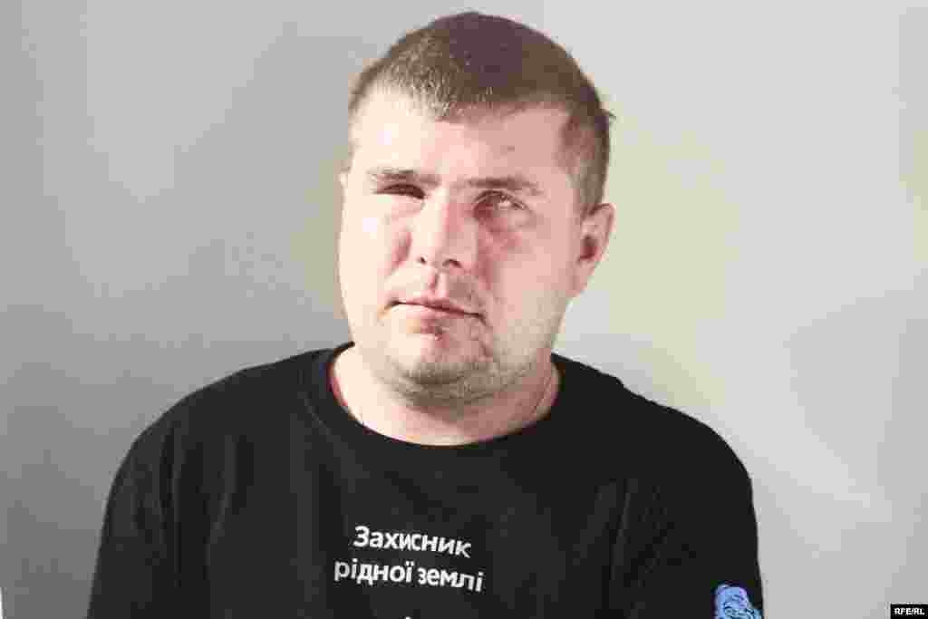 Сахній Ігор. Поранений під Волновахою 11 липня. Мінно-вибухова важка травма очей, ураження кришталиків, випадіння внутрішніх оболонок. Фото Олександра Чекменьова