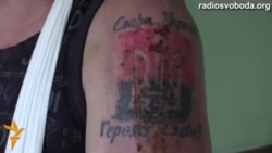 Викрадений сепаратистами шахтар розповів про катування в полоні