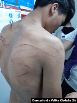 په تصویرونو کې د اکثرو کډوالو پر بدن د تشدد نخښې لیدل کېږي.