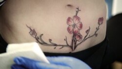 Тату на шрамах Тату на шрамах