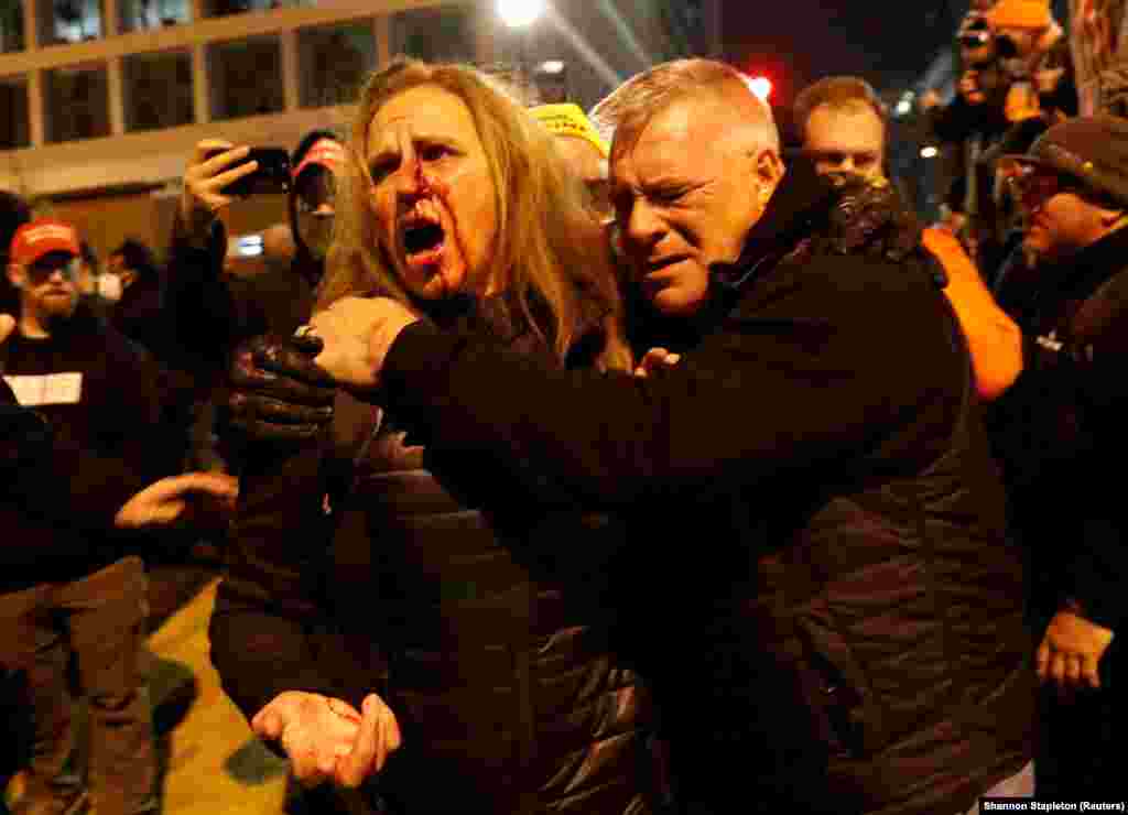 Пораненому прихильникові президента США Дональда Трампа допомагають після зіткнення з контрпротестувальниками під час протестів у Вашингтоні, США, 5 січня 2021 року, напередодні підтвердження Конгресом США результатів виборів у листопаді 2020 року