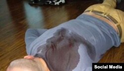 Журналіст Аркадій Бабченко під час опецоперації СБУ, в яку входило інсценування «вбивства» його