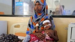 Somalska djeca umiru od gladi nakon obustave pomoći USAID-a Somalska djeca umiru od gladi nakon obustave pomoći USAID-a