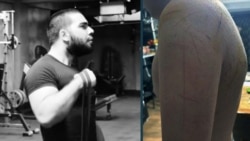 ლევან აბესაძე, რომელსაც გამოძიება არასრულწლოვანის წამების ორგანიზატორად მიიჩნევს და 15 წლის ბიჭის დანით დასერილი სხეული. ფოტოკოლაჟი