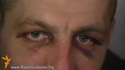 «Беркутівці» скакали по моїй голові і фотографувалися – активіст, якого роздягнув «Беркут» «Беркутівці» скакали по моїй голові і фотографувалися – активіст, якого роздягнув «Беркут»