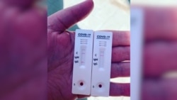 Перенесшие коронавирус – о том, что было самым сложным на пути к выздоровлению Перенесшие коронавирус – о том, что было самым сложным на пути к выздоровлению