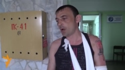 Хотели свести татуировку разбитой лампочкой Хотели свести татуировку разбитой лампочкой