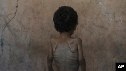 Ілюстраційне фото. Дворічний хлопчик у місті Газа, липень 2025 року