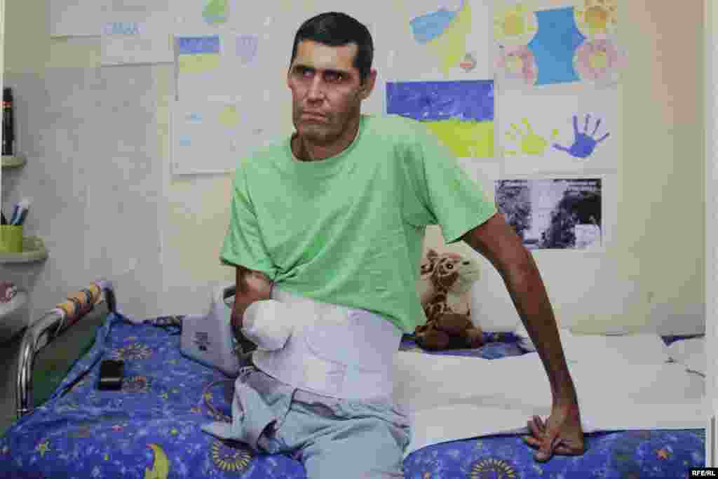 Буйновський В'ячеслав. Доброволець з батальйону "Айдар".Поранений під Щастям. Ампутація правої ноги та руки. Фото Олександра Чекменьова