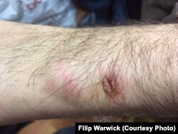 Травма отримана у ході затримання силовиками