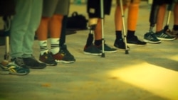 Ампутация Ампутация