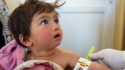 Svetski program za hranu poziva na pomoć kako bi se izbegla 'glad' u Avganistanu Svetski program za hranu poziva na pomoć kako bi se izbegla 'glad' u Avganistanu