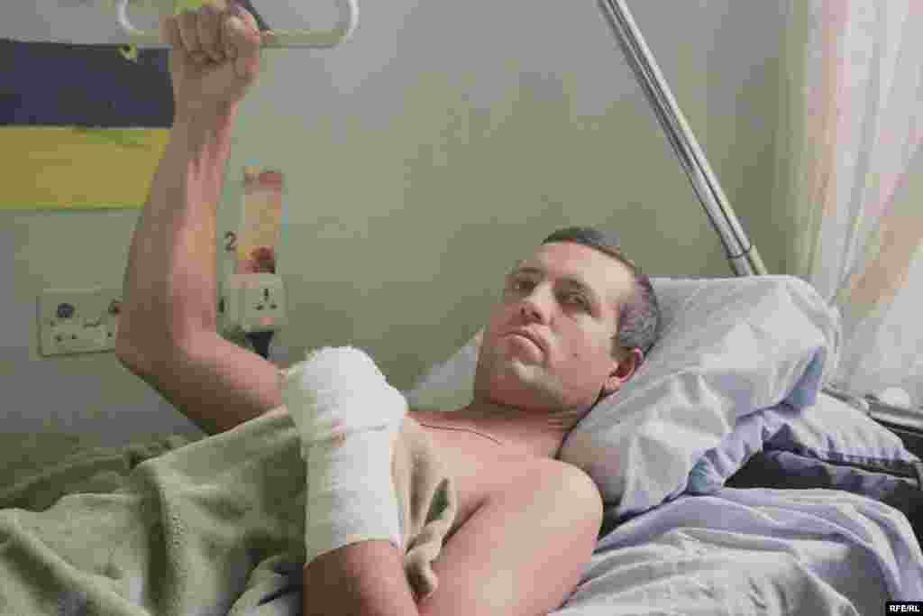 Бєлозьоров Олександр. Мобілізований, 30 бригада, 41 рік. Поранений під Щастям. перелом гомілки, лівої руки, поперекових хребців. Фото Олександра Чекменьова