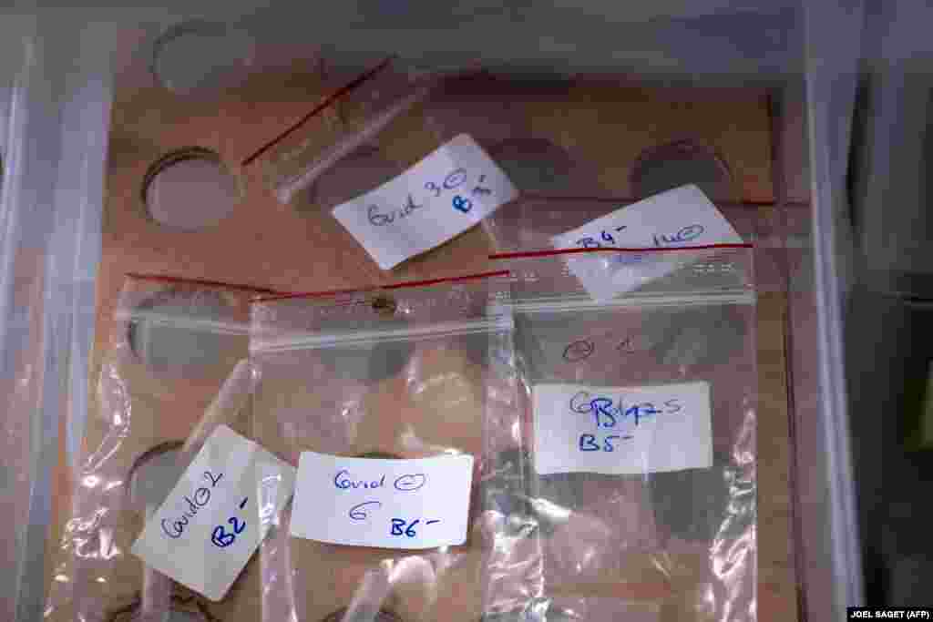 Це спеціальні зразки з COVID-19, що використовуються у Франції для підготовки до тренування собак, щоб навчити їх розпізнавати «запах коронавірусу». Від 13 травня в Мезон-Альфорі, передмісті Парижу, відбувається підготовка і дресирування групи собак для швидкого виявлення коронавірусу завдяки їхньому нюхові. Ініціативою керує професор ветеринарної медицини Домінік Ґранжан