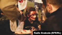 Поранена Марія Зайцева під час протестів у Білорусі. Мінськ, 9 серпня 2020 року