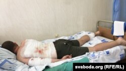 Один із потерпілих унаслідок влучання гумової кулі, Мінськ, Білорусь, серпень 2020 року