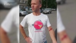 На координатора штаба Навального напали с ножом На координатора штаба Навального напали с ножом