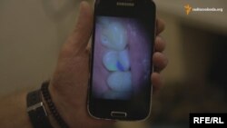 Зубна пломба в кольорах українського прапора