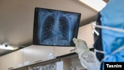 Найбільш ураженими, крім Китаю, є Іран, Італія, Японія і Південна Корея