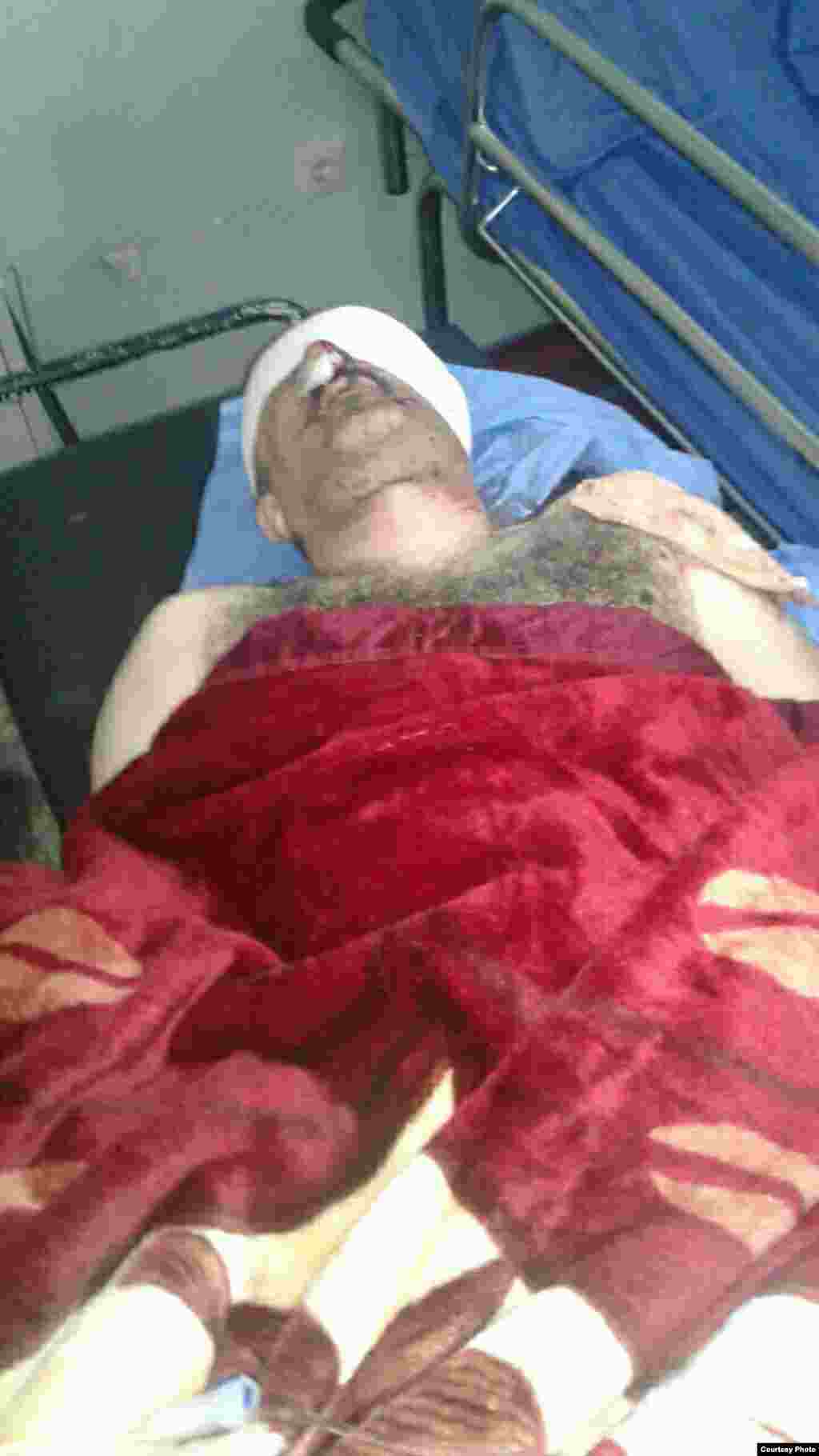 Расул Махмуд був госпіталізований у місті Ірбіль, після поранення під час атаки у Башіці, що за 24 кілометри від Мосула. Ймовірно, він був поранений під час мінометного обстрілу. Лікарі дають невеликий шанс збереження його зору.   