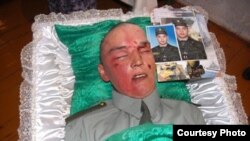 Injuries to Ruslan Aidarkhanov's face and body have prompted his family to claim he was murdered and did not commit suicide, which was given as the cause of death in the official autopsy report.