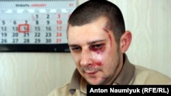 Сергей Вилков на следующий день после нападения. 14 января 2015 года