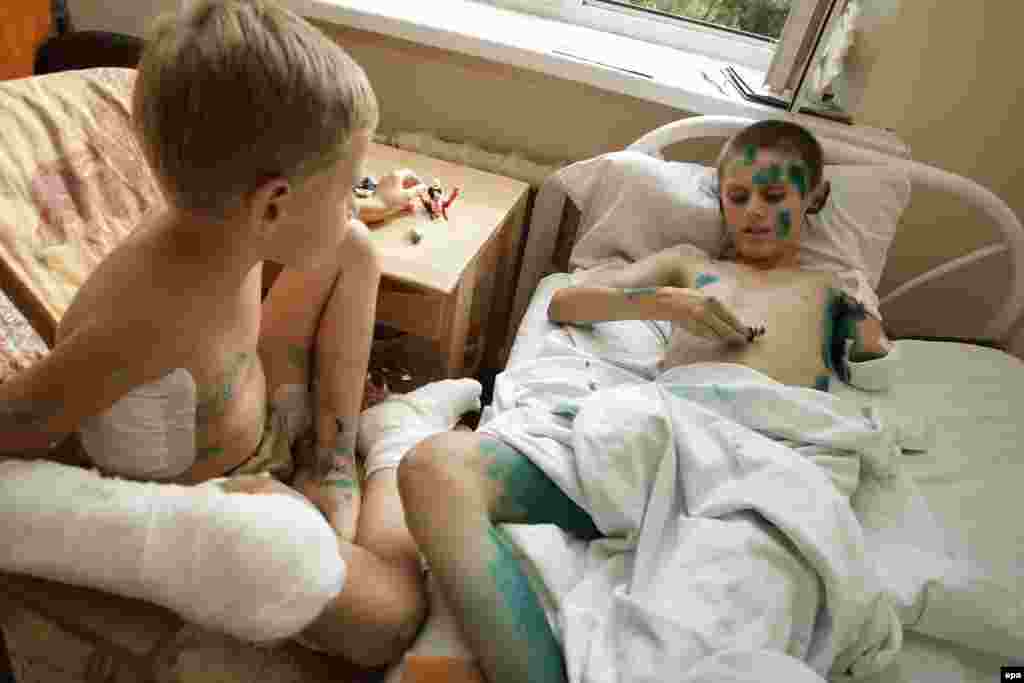 Дмитро (7 років) і Андрій (12 років) в травматологічній лікарні Донецька. Хлопці отримали поранення 7 серпня під час вибуху гранати, яку вони знайшли на полігоні бойовиків угруповання «ДНР». Фото від 15 серпня 2015 року.   