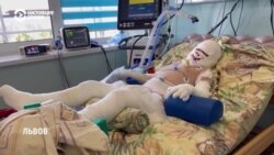 Пострадавший от российских ракетных ударов по Виннице семилетний Роман находится в реанимации Пострадавший от российских ракетных ударов по Виннице семилетний Роман находится в реанимации