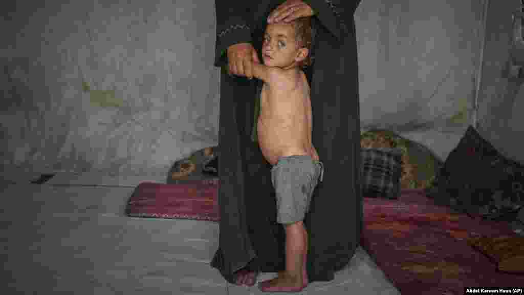 Mohamed Abu Hilal, koji ima dvije godine, pored svoje majke Jasmine, u njihovom šatoru u kampu Muvasi za raseljene Palestince, u Kan Junisu, južni Pojas Gaze, 18. maja 2025.