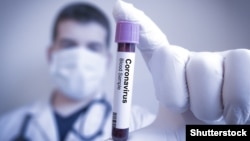 Випадок зараження 26-річної українки коронавірусом в Італії підтвердили 27 лютого