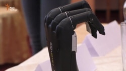 Волонтер із Майдану знову має руку завдяки українським протезистам (відео) Волонтер із Майдану знову має руку завдяки українським протезистам (відео)